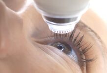 Что нужно знать о лазерной коррекции зрения?