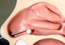 Инородное тело в носу — что делать и куда обращаться