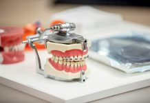 Зуботехнические и стоматологические материалы: выбираем лучшее качество