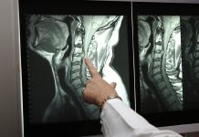 МРТ шейного отдела позвоночника: безопасность, диагностика и преимущества