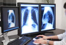 Технология рентген-диагностики: взгляд внутрь организма