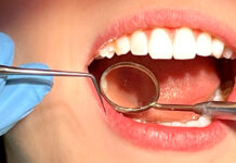 Исправление прикуса: путь к здоровой улыбке