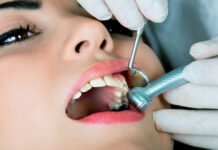 Эффективные методы лечения кариеса: как сохранить здоровье зубов